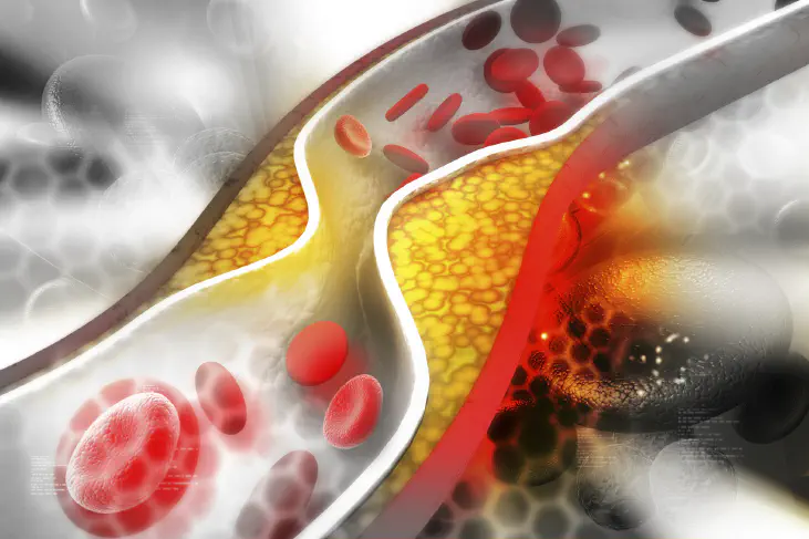 cholesterol